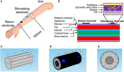 A 3D Computational Model of Transcutaneous Electrical Nerve Stimulation for Estimating Aβ Tactile Nerve Fiber Excitability